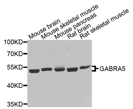 GABRA5 Antibody - Western blot analysis of extracts of various cells.