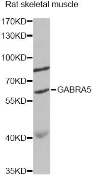 GABRA5 Antibody - Western blot analysis of extracts of rat skeletal muscle, using GABRA5 antibody at 1:1000 dilution. The secondary antibody used was an HRP Goat Anti-Rabbit IgG (H+L) at 1:10000 dilution. Lysates were loaded 25ug per lane and 3% nonfat dry milk in TBST was used for blocking. An ECL Kit was used for detection and the exposure time was 3s.