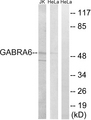 GABRA6 Antibody - Western blot analysis of lysates from HeLa and Jurkat cells, using GABRA6 Antibody. The lane on the right is blocked with the synthesized peptide.