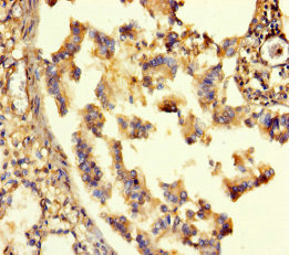 GABRA6 Antibody - Immunohistochemistry of paraffin-embedded human lung tissue using GABRA6 Antibody at dilution of 1:100