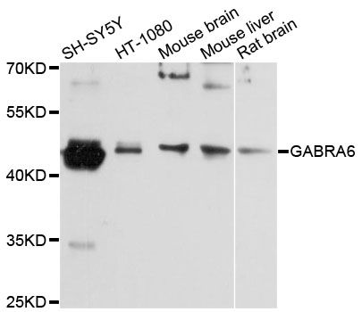 GABRA6 Antibody - Western blot analysis of extracts of various cell lines, using GABRA6 antibody at 1:3000 dilution. The secondary antibody used was an HRP Goat Anti-Rabbit IgG (H+L) at 1:10000 dilution. Lysates were loaded 25ug per lane and 3% nonfat dry milk in TBST was used for blocking. An ECL Kit was used for detection and the exposure time was 10s.