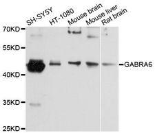 GABRA6 Antibody - Western blot analysis of extracts of various cell lines, using GABRA6 antibody at 1:3000 dilution. The secondary antibody used was an HRP Goat Anti-Rabbit IgG (H+L) at 1:10000 dilution. Lysates were loaded 25ug per lane and 3% nonfat dry milk in TBST was used for blocking. An ECL Kit was used for detection and the exposure time was 10s.