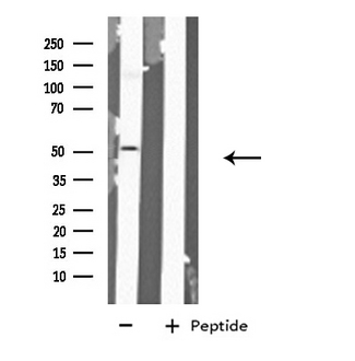 GABRA6 Antibody - Western blot analysis of extracts of HeLa cells using GABRA6 antibody.