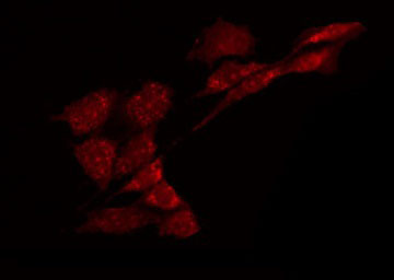 GABRA6 Antibody - Staining HeLa cells by IF/ICC. The samples were fixed with PFA and permeabilized in 0.1% Triton X-100, then blocked in 10% serum for 45 min at 25°C. The primary antibody was diluted at 1:200 and incubated with the sample for 1 hour at 37°C. An Alexa Fluor 594 conjugated goat anti-rabbit IgG (H+L) Ab, diluted at 1/600, was used as the secondary antibody.