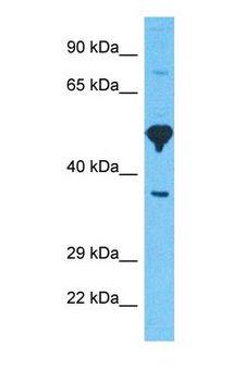 GABRA6 Antibody - Western blot of GBRA6 Antibody with human 293T Whole Cell lysate.  This image was taken for the unconjugated form of this product. Other forms have not been tested.
