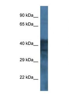 GABRB1 Antibody - GABRB1 antibody Western blot of 8226 Cell lysate. Antibody concentration 1 ug/ml. This image was taken for the unconjugated form of this product. Other forms have not been tested.