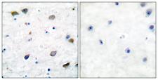 GABRB1 Antibody - Immunohistochemistry analysis of paraffin-embedded human brain tissue, using GABA-RB Antibody. The picture on the right is blocked with the synthesized peptide.