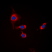GABRB1 Antibody - Immunofluorescent analysis of GABRB1 (pS434) staining in MCF7 cells. Formalin-fixed cells were permeabilized with 0.1% Triton X-100 in TBS for 5-10 minutes and blocked with 3% BSA-PBS for 30 minutes at room temperature. Cells were probed with the primary antibody in 3% BSA-PBS and incubated overnight at 4 deg C in a humidified chamber. Cells were washed with PBST and incubated with a DyLight 594-conjugated secondary antibody (red) in PBS at room temperature in the dark. DAPI was used to stain the cell nuclei (blue).