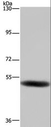 GABRB1 Antibody - Western blot analysis of Human fetal brain tissue, using GABRB1 Polyclonal Antibody at dilution of 1:500.