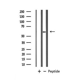 GABRB1 Antibody - Western blot analysis of GABA-RB expression in HeLa whole cells lysates. The lane on the left is treated with the antigen-specific peptide.