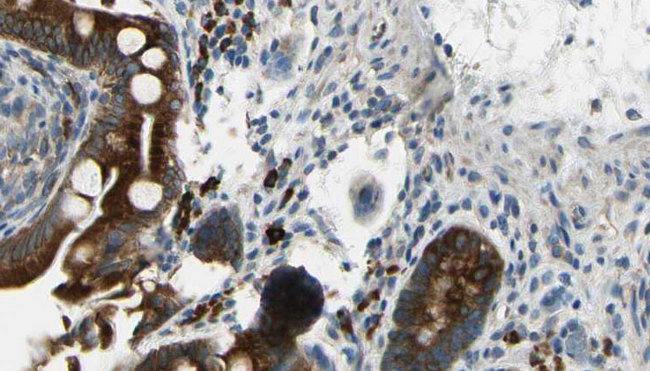 GABRB1 Antibody - 1:100 staining mouse intestine tissue by IHC-P. The sample was formaldehyde fixed and a heat mediated antigen retrieval step in citrate buffer was performed. The sample was then blocked and incubated with the antibody for 1.5 hours at 22°C. An HRP conjugated goat anti-rabbit antibody was used as the secondary.