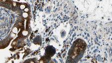 GABRB1 Antibody - 1:100 staining mouse intestine tissue by IHC-P. The sample was formaldehyde fixed and a heat mediated antigen retrieval step in citrate buffer was performed. The sample was then blocked and incubated with the antibody for 1.5 hours at 22°C. An HRP conjugated goat anti-rabbit antibody was used as the secondary.