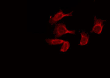 GABRB1 Antibody - Staining COS7 cells by IF/ICC. The samples were fixed with PFA and permeabilized in 0.1% Triton X-100, then blocked in 10% serum for 45 min at 25°C. The primary antibody was diluted at 1:200 and incubated with the sample for 1 hour at 37°C. An Alexa Fluor 594 conjugated goat anti-rabbit IgG (H+L) Ab, diluted at 1/600, was used as the secondary antibody.