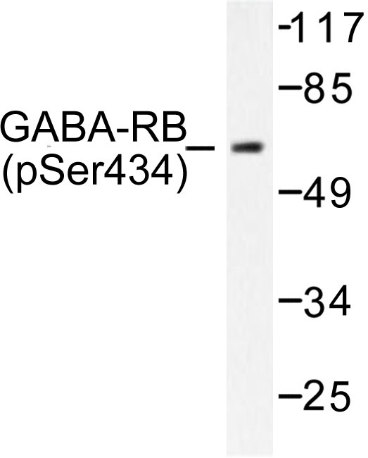 GABRB1 Antibody - Western blot of p-GABAA R beta 1 (S434) pAb in extracts from COS7 cells.
