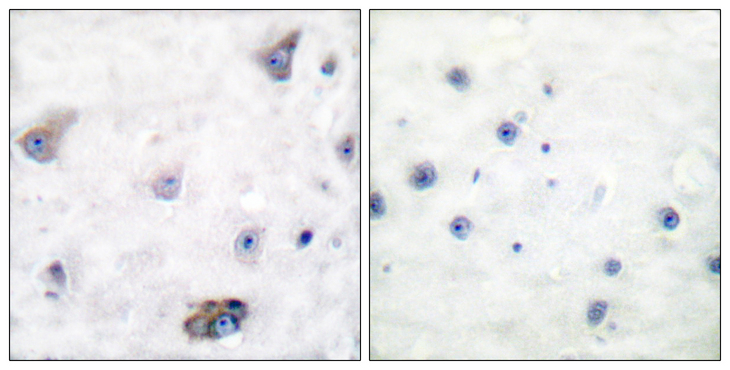 GABRB1 Antibody - Immunohistochemistry analysis of paraffin-embedded human brain, using GABA-RB (Phospho-Ser434) Antibody. The picture on the right is blocked with the phospho peptide.