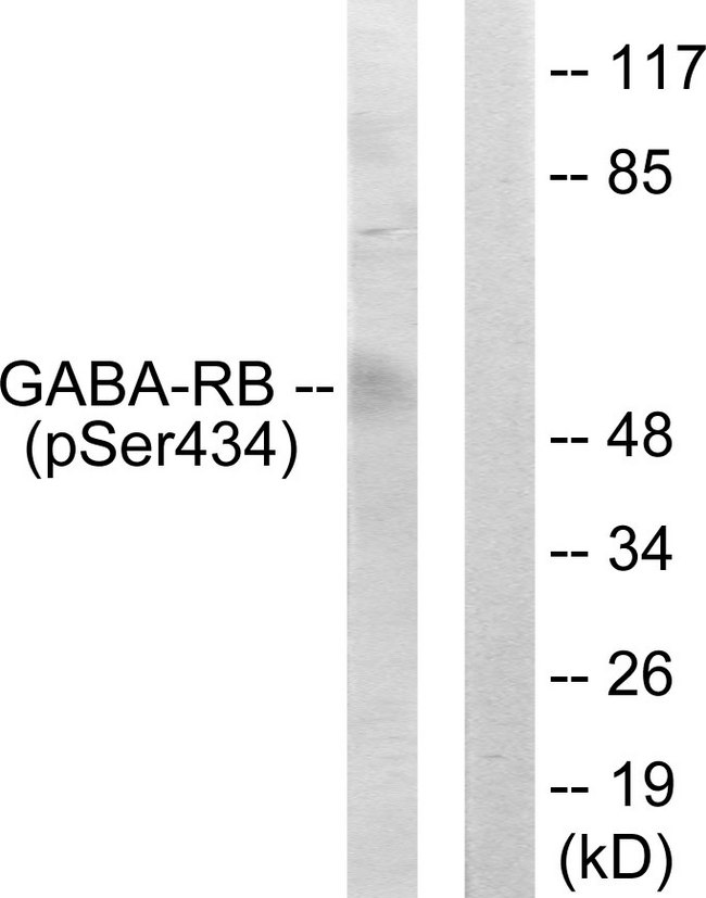 GABRB1 Antibody - Western blot analysis of lysates from COS7 cells, using GABA-RB (Phospho-Ser434) Antibody. The lane on the right is blocked with the phospho peptide.