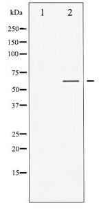 GABRB1 Antibody - Western blot of GABA-RB phosphorylation expression in COS7 whole cell lysates,The lane on the left is treated with the antigen-specific peptide.