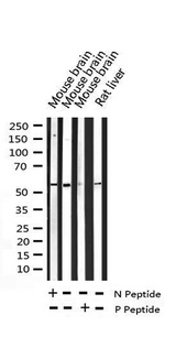 GABRB1 Antibody - Western blot analysis of Phospho-GABA-RB (Ser434) expression in various lysates.  N is non-phosphyorlyated peptide. P is phosphorylated peptide.