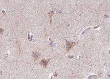 GABRB1 Antibody - 1:100 staining human brain tissue by IHC-P. The tissue was formaldehyde fixed and a heat mediated antigen retrieval step in citrate buffer was performed. The tissue was then blocked and incubated with the antibody for 1.5 hours at 22°C. An HRP conjugated goat anti-rabbit antibody was used as the secondary.