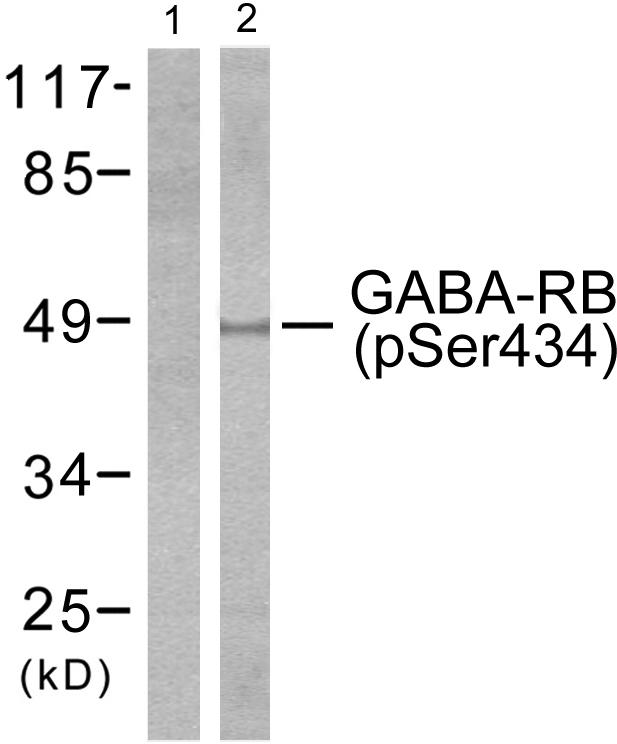 GABRB1 Antibody - Western blot analysis of extracts from cos7 cells, using GABA-RB (phospho-Ser434) antibody.
