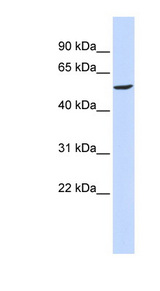GABRB2 Antibody - GABRB2 antibody Western blot of 293T cell lysate. This image was taken for the unconjugated form of this product. Other forms have not been tested.