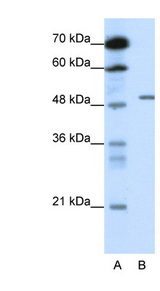 GABRB2 Antibody - GABRB2 antibody Western blot of HepG2 cell lysate. This image was taken for the unconjugated form of this product. Other forms have not been tested.