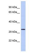 GABRB2 Antibody - GABRB2 antibody Western Blot of Fetal Spleen. Antibody dilution: 1 ug/ml.  This image was taken for the unconjugated form of this product. Other forms have not been tested.