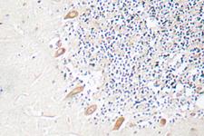 GABRB2 Antibody - IHC of GABAA R2 (R431) pAb in paraffin-embedded human brain tissue.