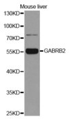 GABRB2 Antibody - Western blot analysis of extracts of mouse liver.