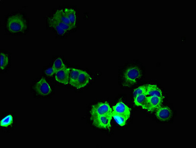 GABRB2 Antibody - Immunofluorescent analysis of MCF-7 cells using GABRB2 Antibody at dilution of 1:100 and Alexa Fluor 488-congugated AffiniPure Goat Anti-Rabbit IgG(H+L)