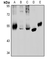 GABRB2 Antibody - Western blot analysis of GABRB2 expression in C6 (A), U87MG (B), HEK293T (C), HCC827 (D), rat lung (E) whole cell lysates.