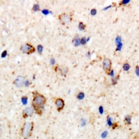 GABRB2 Antibody - Immunohistochemical analysis of GABRB2 staining in human brain formalin fixed paraffin embedded tissue section. The section was pre-treated using heat mediated antigen retrieval with sodium citrate buffer (pH 6.0). The section was then incubated with the antibody at room temperature and detected using an HRP conjugated compact polymer system. DAB was used as the chromogen. The section was then counterstained with haematoxylin and mounted with DPX.