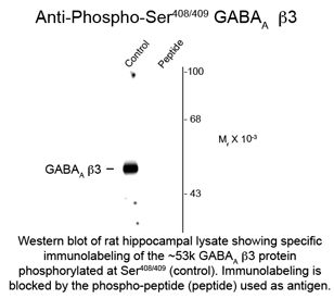 GABRB2 Antibody