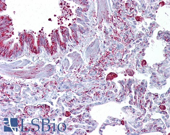 GABRB3 Antibody - Anti-GABRB3 antibody IHC of human lung. Immunohistochemistry of formalin-fixed, paraffin-embedded tissue after heat-induced antigen retrieval. Antibody concentration 5 ug/ml.  This image was taken for the unconjugated form of this product. Other forms have not been tested.