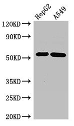 GABRB3 Antibody - Positive WB detected in:HepG2 whole cell lysate,A549 whole cell lysate;All lanes:GABRB3 antibody at 2.7?g/ml;Secondary;Goat polyclonal to rabbit IgG at 1/50000 dilution;Predicted band size: 55,47,46 KDa;Observed band size: 55 KDa;