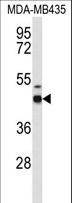 GABRD Antibody - Western blot of GABRD Antibody in MDA-MB435 cell line lysates (35 ug/lane). GABRD (arrow) was detected using the purified antibody.