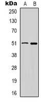 GABRD Antibody - Western blot analysis of GABRD expression in HT29 (A); PC12 (B) whole cell lysates.