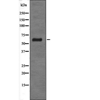 GABRD Antibody - Western blot analysis of extracts of HT29 cells using GABRD antibody.