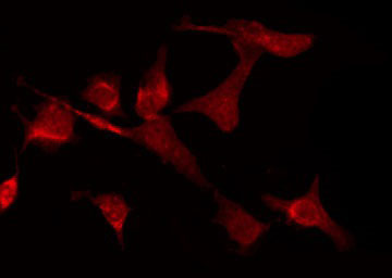 GABRD Antibody - Staining LOVO cells by IF/ICC. The samples were fixed with PFA and permeabilized in 0.1% Triton X-100, then blocked in 10% serum for 45 min at 25°C. The primary antibody was diluted at 1:200 and incubated with the sample for 1 hour at 37°C. An Alexa Fluor 594 conjugated goat anti-rabbit IgG (H+L) Ab, diluted at 1/600, was used as the secondary antibody.