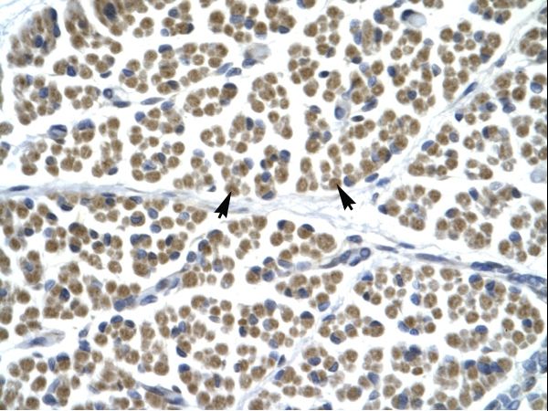 GABRD Antibody - Human Muscle.  This image was taken for the unconjugated form of this product. Other forms have not been tested.