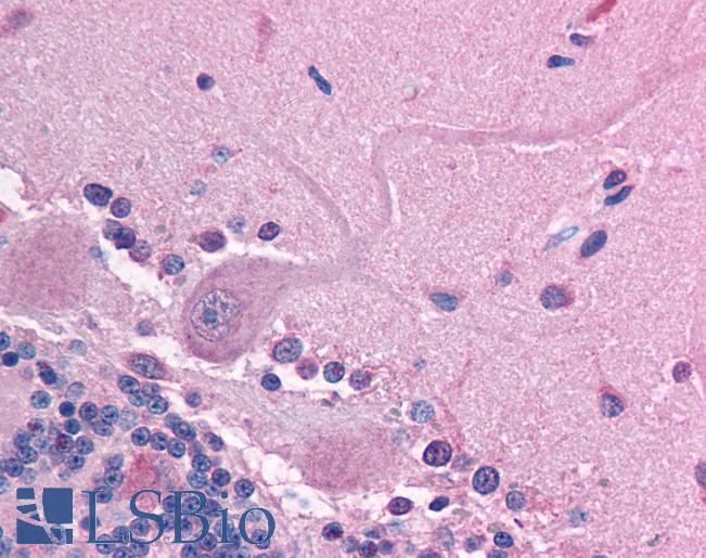 GABRE Antibody - Anti-GABRE antibody IHC of human brain, cerebellum. Immunohistochemistry of formalin-fixed, paraffin-embedded tissue after heat-induced antigen retrieval. Antibody concentration 5 ug/ml.  This image was taken for the unconjugated form of this product. Other forms have not been tested.