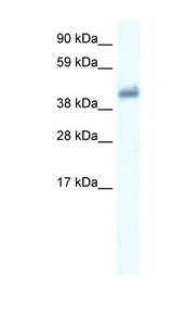 GABRE Antibody - GABRE antibody Western blot of Placenta lysate. This image was taken for the unconjugated form of this product. Other forms have not been tested.