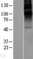 GABRE Protein - Western validation with an anti-DDK antibody * L: Control HEK293 lysate R: Over-expression lysate