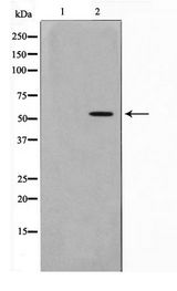 GABRG1 Antibody - Western blot of LOVO cell lysate using GABRG1 Antibody