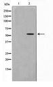GABRG1 Antibody - Western blot of LOVO cell lysate using GABRG1 Antibody