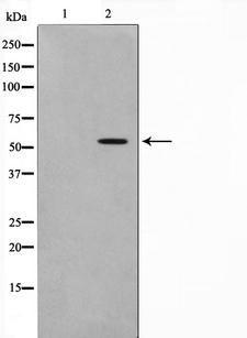 GABRG1 Antibody - Western blot analysis on LOVO cells cell lysates using GABRG1 antibody. The lane on the left is treated with the antigen-specific peptide.
