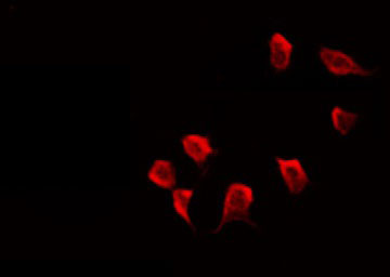 GABRG1 Antibody - Staining LOVO cells by IF/ICC. The samples were fixed with PFA and permeabilized in 0.1% Triton X-100, then blocked in 10% serum for 45 min at 25°C. The primary antibody was diluted at 1:200 and incubated with the sample for 1 hour at 37°C. An Alexa Fluor 594 conjugated goat anti-rabbit IgG (H+L) Ab, diluted at 1/600, was used as the secondary antibody.