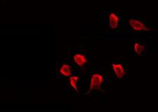 GABRG1 Antibody - Staining LOVO cells by IF/ICC. The samples were fixed with PFA and permeabilized in 0.1% Triton X-100, then blocked in 10% serum for 45 min at 25°C. The primary antibody was diluted at 1:200 and incubated with the sample for 1 hour at 37°C. An Alexa Fluor 594 conjugated goat anti-rabbit IgG (H+L) Ab, diluted at 1/600, was used as the secondary antibody.