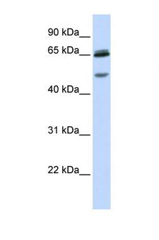 GABRG2 Antibody - GABRG2 antibody Western blot of Fetal Brain lysate. Antibody concentration 1 ug/ml. This image was taken for the unconjugated form of this product. Other forms have not been tested.