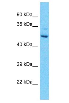 GABRG2 Antibody - GABRG2 antibody Western Blot of Esophagus Tumor. Antibody dilution: 1 ug/ml.  This image was taken for the unconjugated form of this product. Other forms have not been tested.